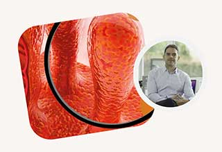 Microbiota-Inmunonutrición - Osorio